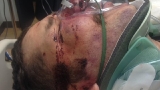Mother says her son is paralyzed after a fight over a t-shirt