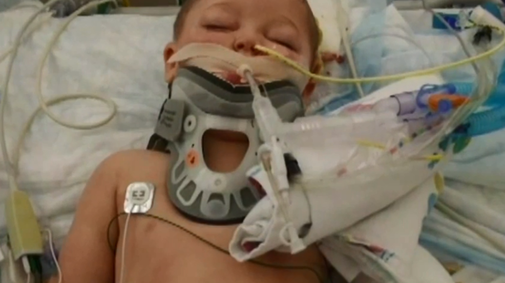 2 Year Old Boy Attacked By Pit Bull Undergoes 16 Hour Surgery To