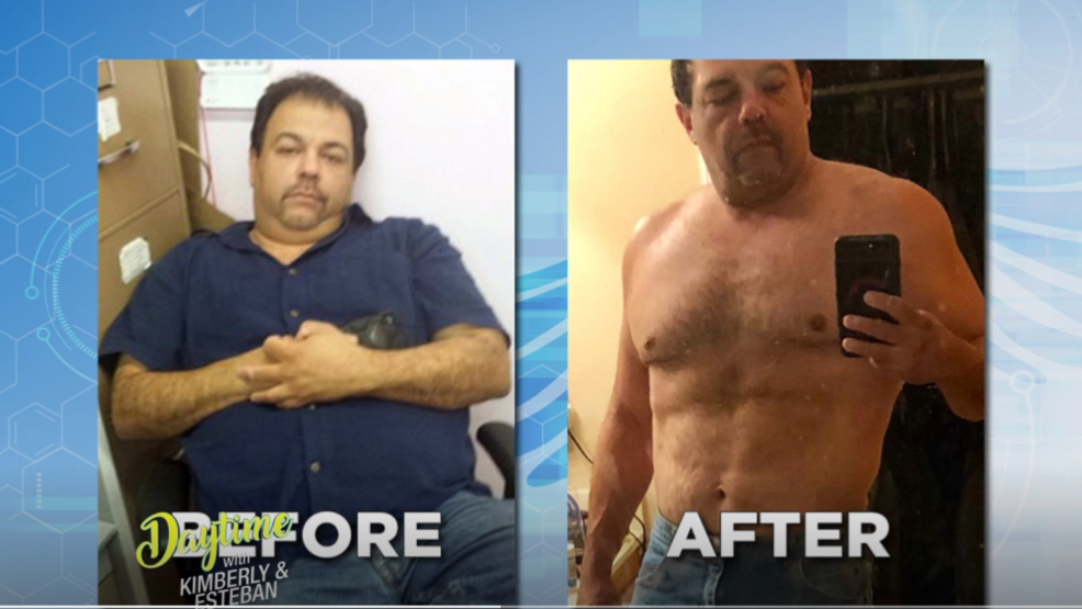 Treating low testosterone levels Watch Daytime