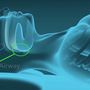 Implanted sleep apnea device promises safer, uninterrupted sleep, doctors say